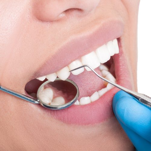 otturazioni estetiche